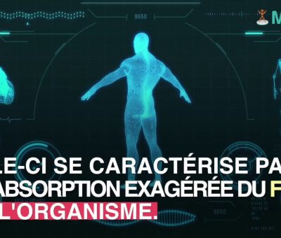Hémochromatose : Conseils alimentation